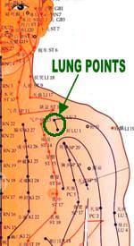 LungPoints
